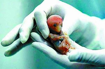 代怀选性别包生男孩代生医院